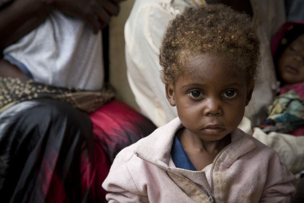 In places like the DRC, children suffer malnutrition because they are fleeing from violence
