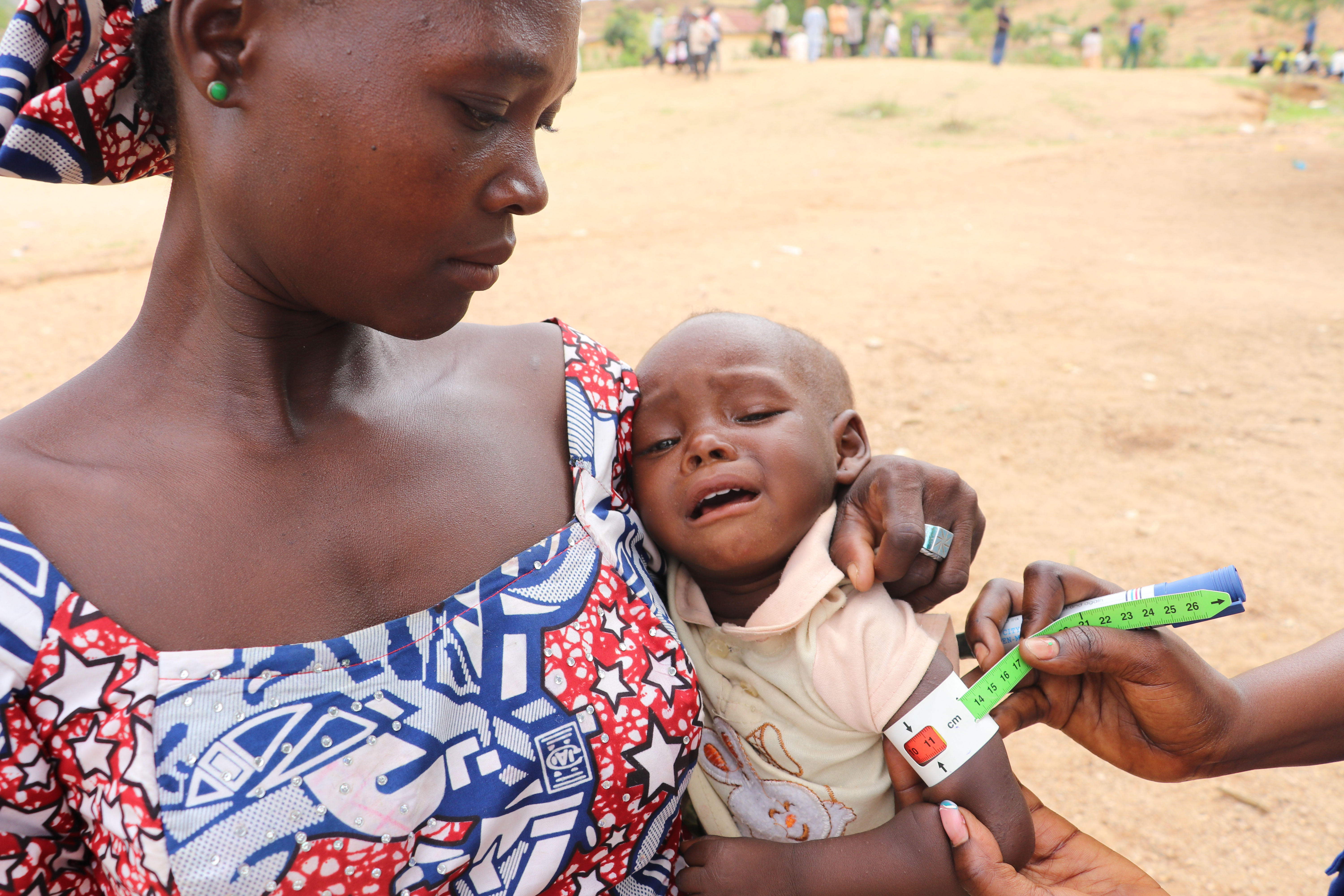 A mother holds her crying child, the band on the child's arm shows red