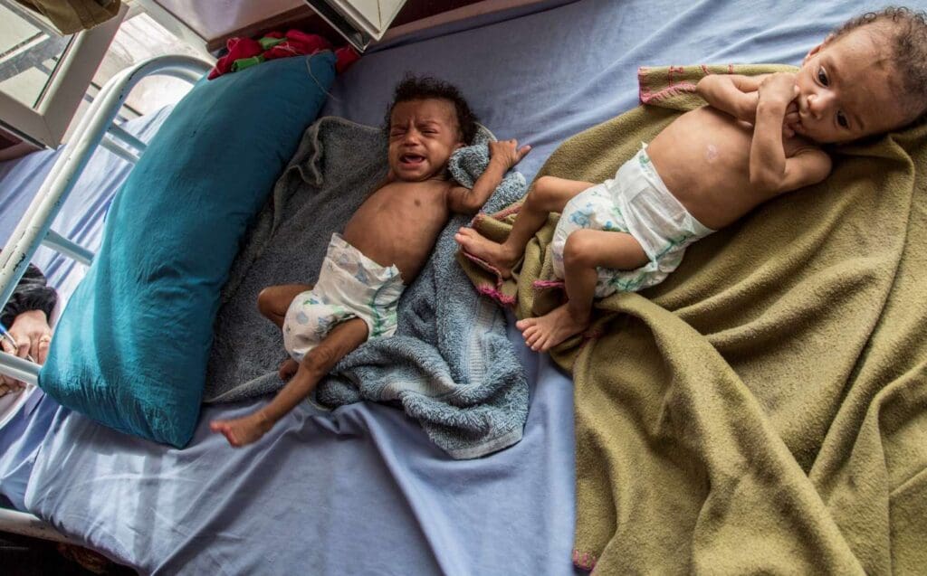 underweight twins cry on a hospital bed