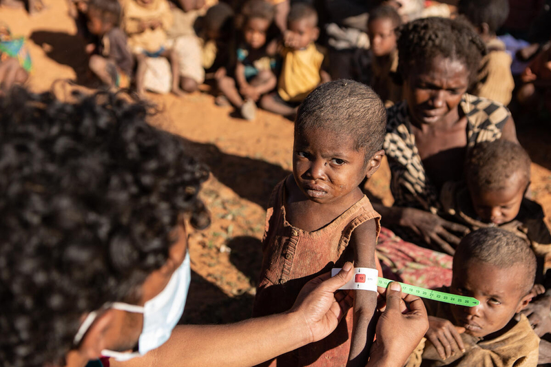 young child having his arm measured