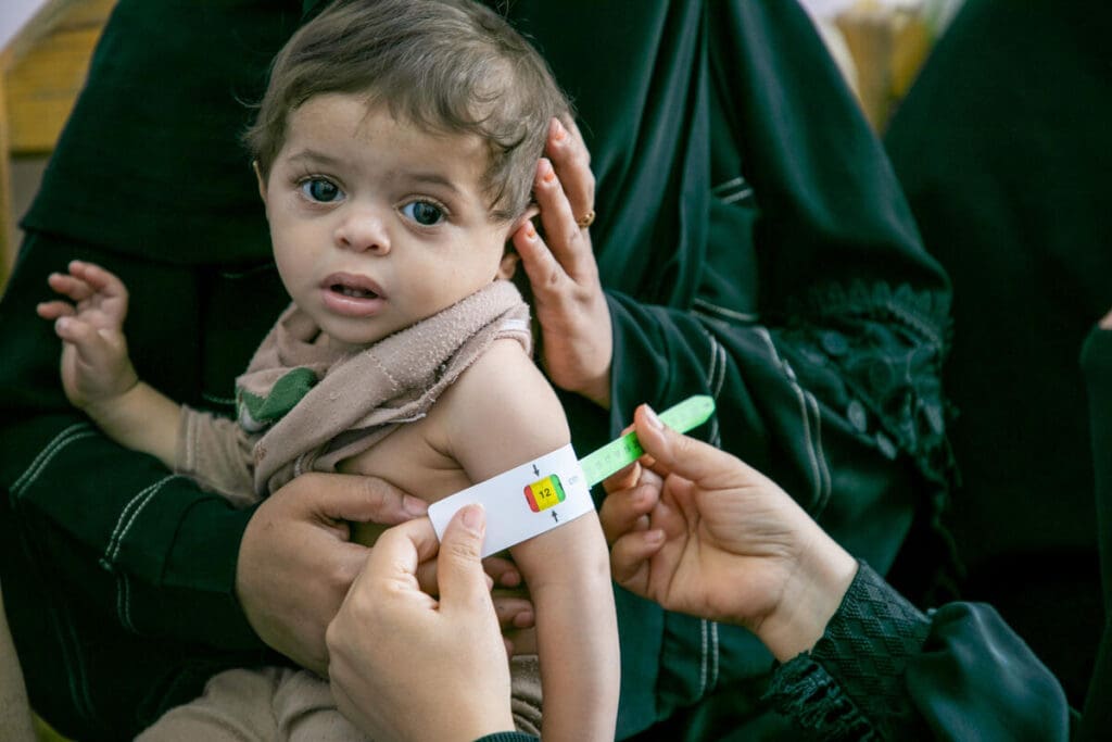 Mohammed is tested for malnutrition in Yemen