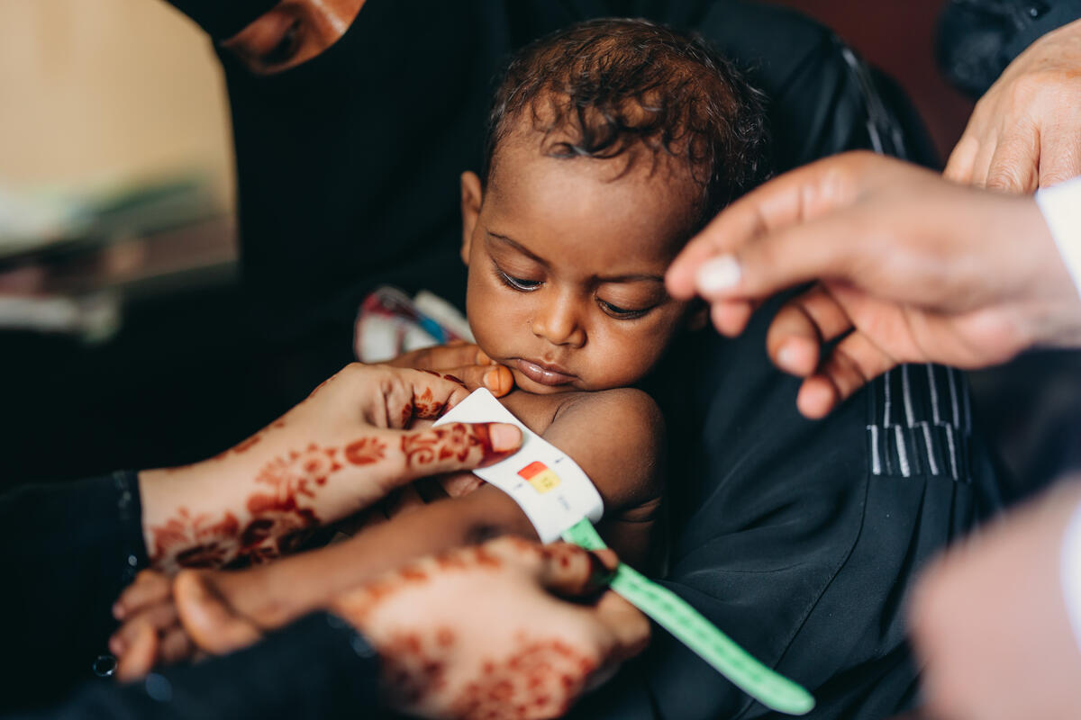A young child is checked for malnutrition in Yemen